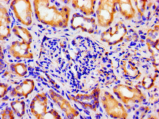 Immunohistochemistry of paraffin-embedded human kidney tissue using CSB-PA002160LA01HU at dilution of 1:100