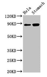 Western Blot Positive WB detected in: Hela whole cell lysate, Rat stomach tissue All lanes: ASAH2 antibody at 3µg/ml Secondary Goat polyclonal to rabbit IgG at 1/50000 dilution Predicted band size: 86, 82 kDa Observed band size: 86 kDa