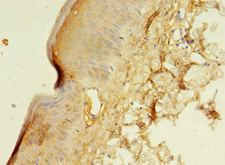 Immunohistochemistry of paraffin-embedded human skin tissue using CSB-PA002171LA01HU at dilution of 1:100