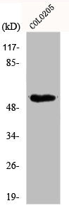 Western Blot analysis of COLO205 cells using Dok-2 Polyclonal Antibody