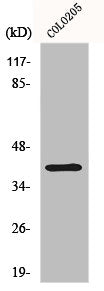 Western Blot analysis of COLO205 cells using Dok-6 Polyclonal Antibody