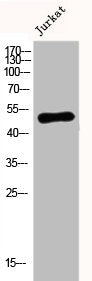 Western Blot analysis of Jurkat cells using DR4 Polyclonal Antibody
