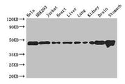 Western Blot Positive WB detected in: Hela whole cell lysate, HEK293 whole cell lysate, Jurkat whole cell lysate, Mouse heart tissue, Mouse liver tissue, Mouse lung tissue, Mouse kidney tissue, Mouse brain tissue, Mouse stomach tissue All lanes: A...