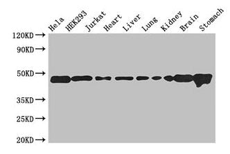 Western Blot Positive WB detected in: Hela whole cell lysate, HEK293 whole cell lysate, Jurkat whole cell lysate, Mouse heart tissue, Mouse liver tissue, Mouse lung tissue, Mouse kidney tissue, Mouse brain tissue, Mouse stomach tissue All lanes: A...