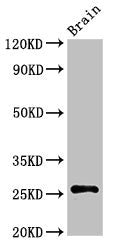 Western Blot Positive WB detected in: Rat brain tissue All lanes: ASCL1 antibody at 3ug/ml Secondary Goat polyclonal to rabbit IgG at 1/50000 dilution Predicted band size: 26 kDa Observed band size: 26 kDa