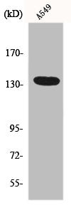 Western Blot analysis of HepG2 cells using DREG Polyclonal Antibody
