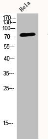 Western Blot analysis of HELA cells using DRP1 Polyclonal Antibody