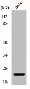 Western Blot analysis of HeLa cells using DSCR 1 Polyclonal Antibody