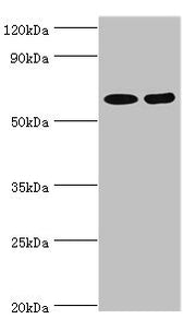 Western blot All lanes: N-acetylserotonin O-methyltransferase-like protein antibody at 2ug/ml Lane 1: Hela whole cell lysate Lane 2: A549 whole cell lysate Secondary Goat polyclonal to rabbit IgG at 1/10000 dilution Predicted band size: 69, 68, 63...