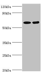 Western blot All lanes: N-acetylserotonin O-methyltransferase-like protein antibody at 2ug/ml Lane 1: Hela whole cell lysate Lane 2: A549 whole cell lysate Secondary Goat polyclonal to rabbit IgG at 1/10000 dilution Predicted band size: 69, 68, 63...