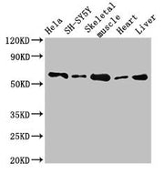 Western Blot Positive WB detected in: Hela whole cell lysate, SH-SY5Y whole cell lysate, Mouse skeletal muscle tissue, Rat heart tissue, Rat liver tissue All lanes: ASNS antibody at 2.7µg/ml Secondary Goat polyclonal to rabbit IgG at 1/50000 dilut...