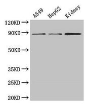 Western Blot Positive WB detected in: A549 whole cell lysate, HepG2 whole cell lysate, Mouse kidney tissue All lanes: ASPH antibody at 3µg/ml Secondary Goat polyclonal to rabbit IgG at 1/50000 dilution Predicted band size: 86, 35, 26, 24, 34, 84,...