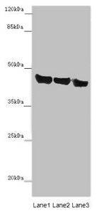 Western blot All lanes: ASPN antibody at 14 ug/ml Lane 1: Mouse heart tissue Lane 2: Mouse liver tissue Lane 3: HL60 whole cell lysate Secondary Goat polyclonal to rabbit IgG at 1/10000 dilution Predicted band size: 43 kDa Observed band size: 43 kDa