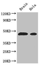 Western Blot Positive WB detected in: Mouse brain tissue, Hela whole cell lysate All lanes: ASS1 antibody at 3µg/ml Secondary Goat polyclonal to rabbit IgG at 1/50000 dilution Predicted band size: 47 kDa Observed band size: 47 kDa