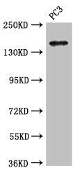 Western Blot Positive WB detected in: PC-3 whole cell lysate All lanes: ASTN2 antibody at 3.4µg/ml Secondary Goat polyclonal to rabbit IgG at 1/50000 dilution Predicted band size: 149, 143, 148, 50, 45 kDa Observed band size: 149 kDa