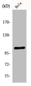 Western Blot analysis of HeLa cells using eEF2K Polyclonal Antibody
