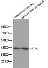 Western blot analysis of extracts from mouse craniofacial and mouse gastrocnemius, using ATF4 antibody.