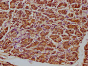 IHC image of CSB-PA002276LA01HU diluted at 1:100 and staining in paraffin-embedded human pancreatic tissue performed on a Leica BondTM system. After dewaxing and hydration, antigen retrieval was mediated by high pressure in a citrate buffer (pH 6....