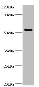 Western blot All lanes: ATF7 antibody at 12ug/ml + Hela whole cell lysate Secondary Goat polyclonal to rabbit IgG at 1/10000 dilution Predicted band size: 53, 50, 51, 34, 14, 52 kDa Observed band size: 53 kDa