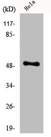 Western Blot analysis of Jurkat cells using Egr-2 Polyclonal Antibody