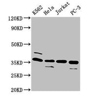 Western Blot Positive WB detected in: K562 whole cell lysate, Hela whole cell lysate, Jurkat whole cell lysate, PC-3 whole cell lysate All lanes: ATG3 antibody at 4µg/ml Secondary Goat polyclonal to rabbit IgG at 1/50000 dilution Predicted band si...