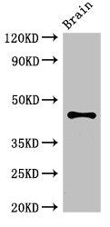 Western Blot Positive WB detected in: Mouse brain tissue All lanes: ATG4B antibody at 3.4ug/ml Secondary Goat polyclonal to rabbit IgG at 1/50000 dilution Predicted band size: 45, 53, 32, 38, 43 kDa Observed band size: 45 kDa