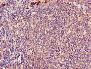 Immunohistochemistry of paraffin-embedded human lymph node tissue using CSB-PA002299LA01HU at dilution of 1:100