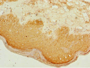 Immunohistochemistry of paraffin-embedded human skin tissue using CSB-PA002304ESR2HU at dilution of 1:100