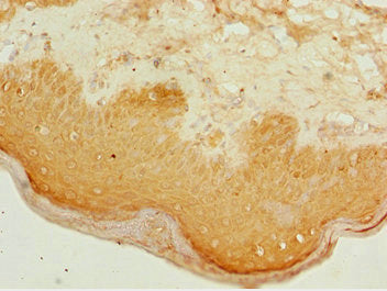 Immunohistochemistry of paraffin-embedded human skin tissue using CSB-PA002304ESR2HU at dilution of 1:100