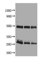 Western blot All lanes : Rat IgG antibody at 2ug/ml Lane 1 : Rat IgG protein 70ng Lane 2 : Rat IgG protein 50ng Lane 3 : Rat IgG protein 30ng Secondary Goat polyclonal to Rabbit IgG at 1/50000 dilution