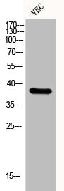 Western Blot analysis of VEC cells using EKLF/CKLF/UKLF Polyclonal Antibody