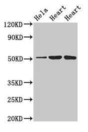 Western Blot Positive WB detected in: Hela whole cell lysate, Rat heart tissue, Mouse heart tissue All lanes: ATP1B1 antibody at 3µg/ml Secondary Goat polyclonal to rabbit IgG at 1/50000 dilution Predicted band size: 36, 35 kDa Observed band size:...