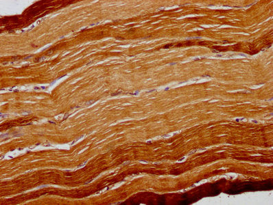 IHC image of CSB-PA002332LA01HU diluted at 1:300 and staining in paraffin-embedded human skeletal muscle tissue performed on a Leica BondTM system. After dewaxing and hydration, antigen retrieval was mediated by high pressure in a citrate buffer (...