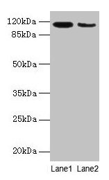Western blot All lanes: ATP2A2 antibody at 6µg/ml Lane 1: Mouse heart tissue Lane 2: Mouse skeletal muscle tissue Secondary Goat polyclonal to rabbit IgG at 1/10000 dilution Predicted band size: 115, 110, 112 kDa Observed band size: 115 kDa