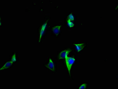 Immunofluorescence staining of A549 cells with CSB-PA002340LA01HU at 1:100, counter-stained with DAPI. The cells were fixed in 4% formaldehyde, permeabilized using 0.2% Triton X-100 and blocked in 10% normal Goat Serum. The cells were then incubat...