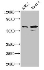 Western Blot Positive WB detected in: K562 whole cell lysate, Mouse heart tissue All lanes: ATP5F1A antibody at 2.5ug/ml Secondary Goat polyclonal to rabbit IgG at 1/50000 dilution Predicted band size: 60, 55, 58 kDa Observed band size: 60 kDa