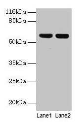 Western blot All lanes: ATP5F1A antibody at 2µg/ml Lane 1: Hela whole cell lysate Lane 2: COLO205 whole cell lysate Secondary Goat polyclonal to rabbit IgG at 1/10000 dilution Predicted band size: 60, 55, 58 kDa Observed band size: 60 kDa