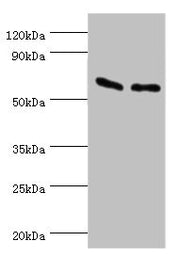 Western blot All lanes: ATP synthase subunit beta, mitochondrial antibody at 9ug/ml Lane 1: Hela whole cell lysate Lane 2: HepG2 whole cell lysate Secondary Goat polyclonal to rabbit IgG at 1/10000 dilution Predicted band size: 57 kDa Observed ban...