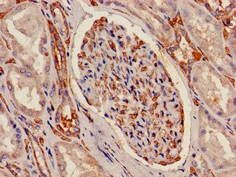 Immunohistochemistry of paraffin-embedded human kidney tissue using CSB-PA002353LA01HU at dilution of 1:100