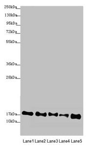 Western blot All lanes: ATP5F1D antibody at 2.44µg/ml Lane 1: Mouse heart tissue Lane 2: Raji whole cell lysate Lane 3: NIH/3T3 whole cell lysate Lane 4: A549 whole cell lysate Lane 5: HepG2 whole cell lysate Secondary Goat polyclonal to rabbit Ig...