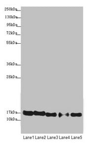 Western blot All lanes: ATP5F1D antibody at 1.94µg/ml Lane 1: Raji whole cell lysate Lane 2: NIH/3T3 whole cell lysate Lane 3: A549 whole cell lysate Lane 4: MDA-MB-231 whole cell lysate Lane 5: HepG2 whole cell lysate Secondary Goat polyclonal to...