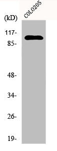 Western Blot analysis of COLO205 cells using EphA1 Polyclonal Antibody