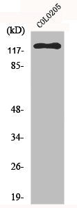 Western Blot analysis of HeLa cells using EphB6 Polyclonal Antibody