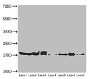 Western blot All lanes: ATP5H antibody at 5.16 ug/ml Lane 1: Mouse kidney tissue Lane 2: Mouse liver tissue Lane 3: Mouse brain tissue Lane 4: Hela whole cell lysate Lane 5: HepG2 whole cell lysate Lane 6: PC-3 whole cell lysate Lane 7: U251 whole...