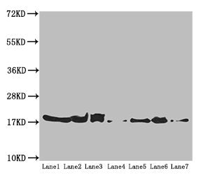 Western blot All lanes: ATP5H antibody at 5.16 ug/ml Lane 1: Mouse kidney tissue Lane 2: Mouse liver tissue Lane 3: Mouse brain tissue Lane 4: Hela whole cell lysate Lane 5: HepG2 whole cell lysate Lane 6: PC-3 whole cell lysate Lane 7: U251 whole...