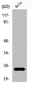 Western Blot analysis of COLO205 cells using Ephrin-A2 Polyclonal Antibody