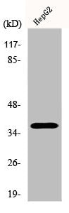 Western Blot analysis of Jurkat cells using Ephrin-A3 Polyclonal Antibody