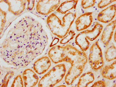 IHC image of CSB-PA002374LA01HU diluted at 1:600 and staining in paraffin-embedded human kidney tissue performed on a Leica BondTM system. After dewaxing and hydration, antigen retrieval was mediated by high pressure in a citrate buffer (pH 6.0)....