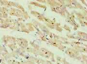 Immunohistochemistry of paraffin-embedded human heart tissue using CSB-PA002379ESR1HU at dilution of 1:100