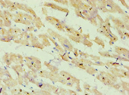 Immunohistochemistry of paraffin-embedded human heart tissue using CSB-PA002379ESR1HU at dilution of 1:100